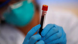 AI can identify early warning signs in blood test findings.
